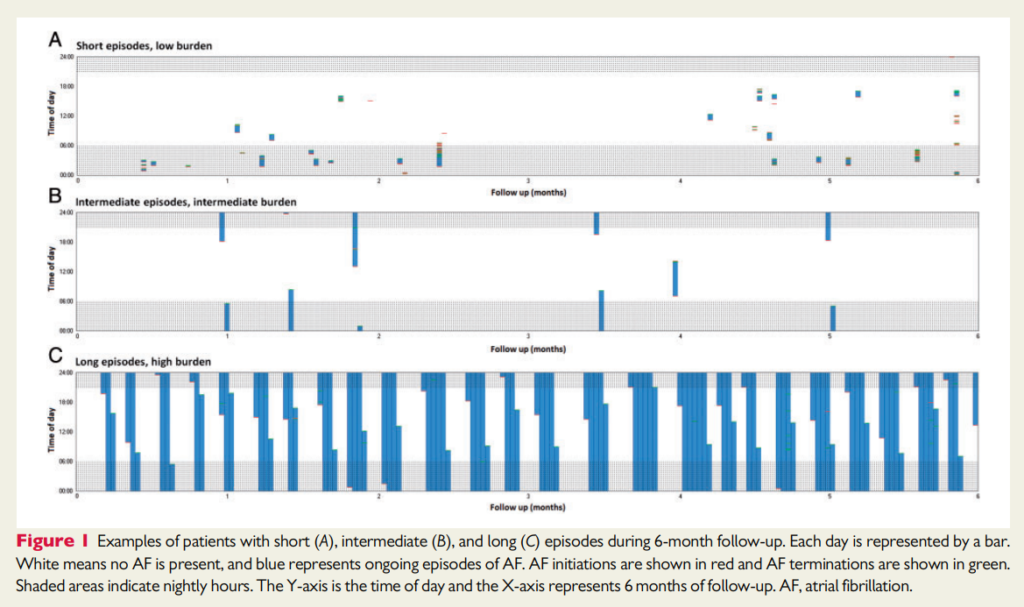 Examples of patients with short (A), intermediate (B), and long (C) episodes during 6-month follow-up, registered with ILR.